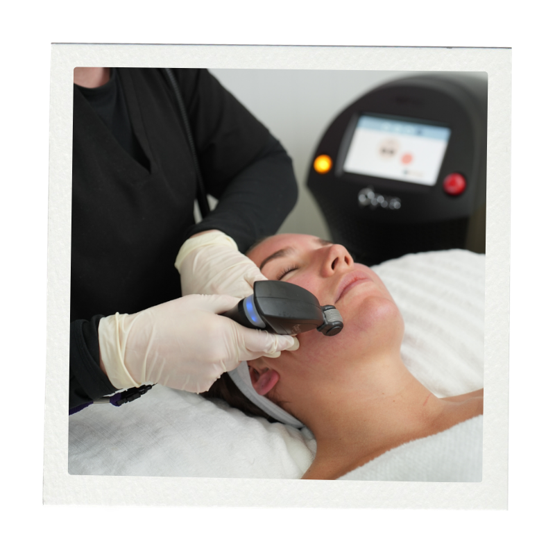 Lasers, Explained: Finding the Right Treatment for Your Skin — SKN ...