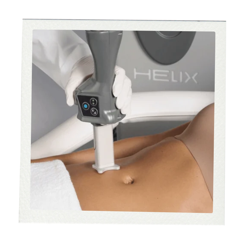 Introducing HELIX CO₂ Laser to SKN Dermatology — SKN Dermatology ...