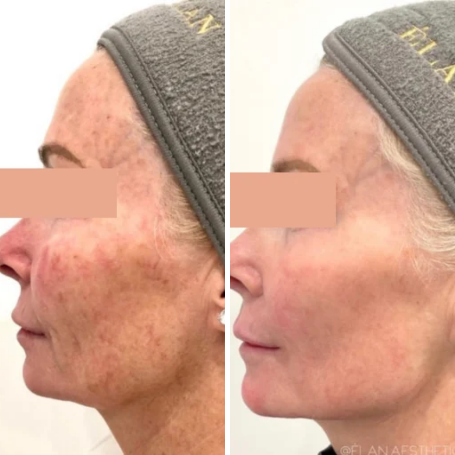 CoolPeel (3).png