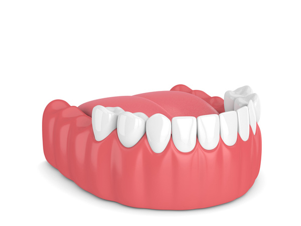 Dental model showing artificial gums and teeth, including a dental crown on a molar.