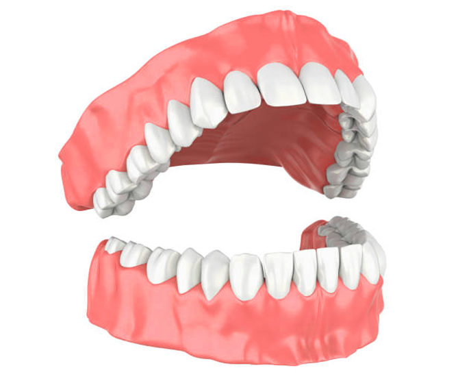 3D illustration of open human dentures showing teeth and gums