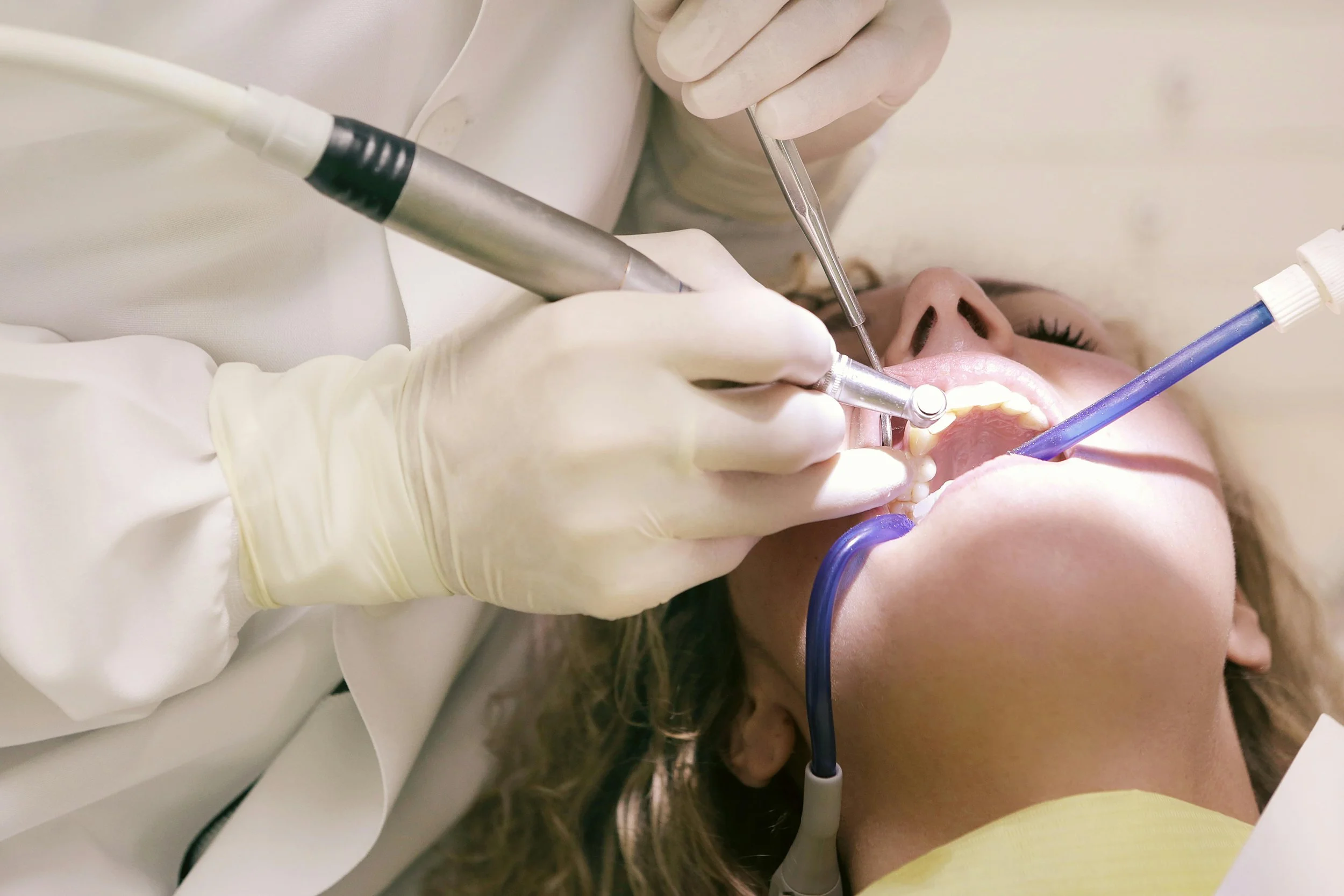 Dentist performing dental procedure on a patient with tools and suction device.
