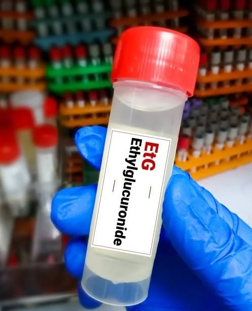 Comprehensive Drug Testing Services in Houston: A Complete Guide for Probation, UA, ETG &amp; Rapid Testing