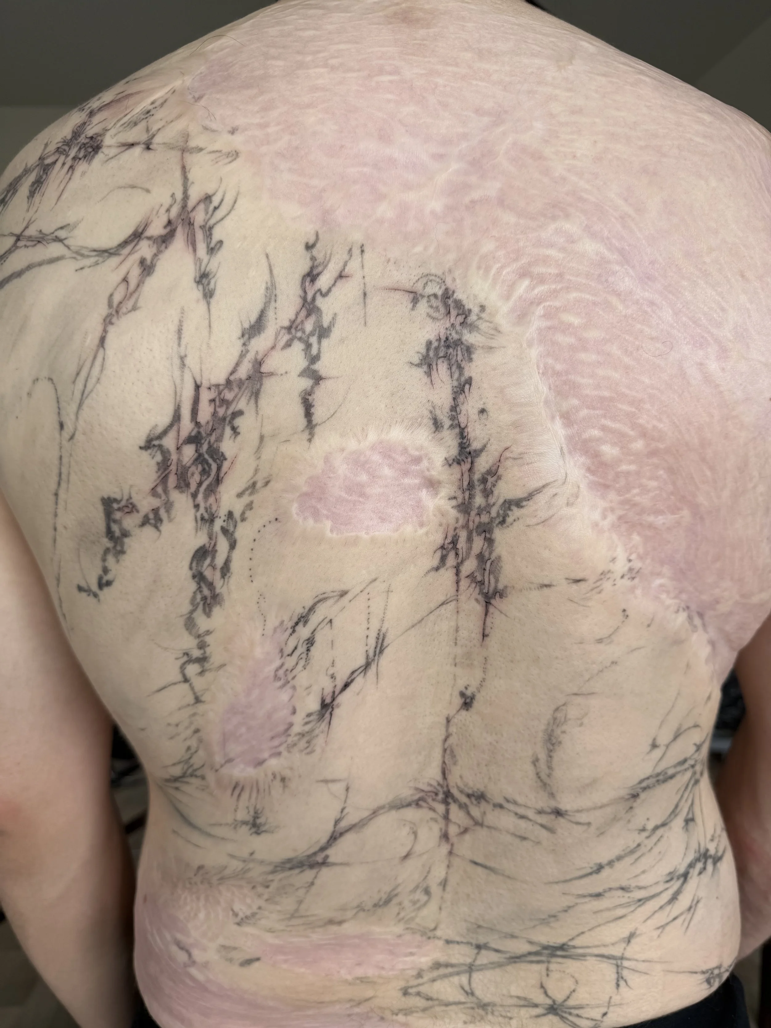 A person's back with fresh tattooing in progress, containing various abstract and sketch-like black ink designs, along with areas of healing skin.