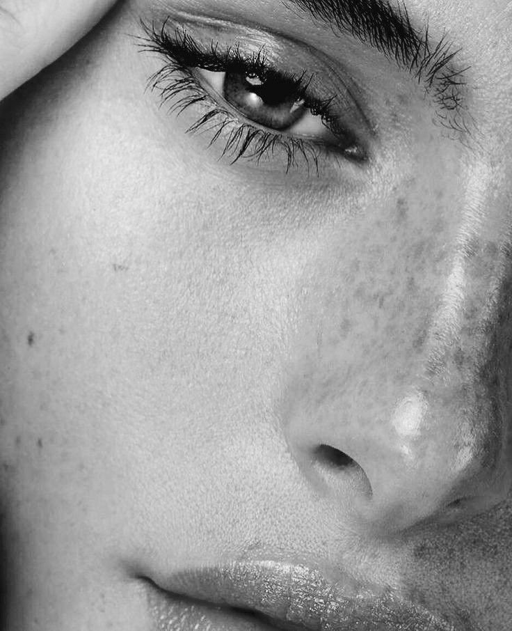 Close-up of a person's face highlighting an eye, freckles, and partial lips.