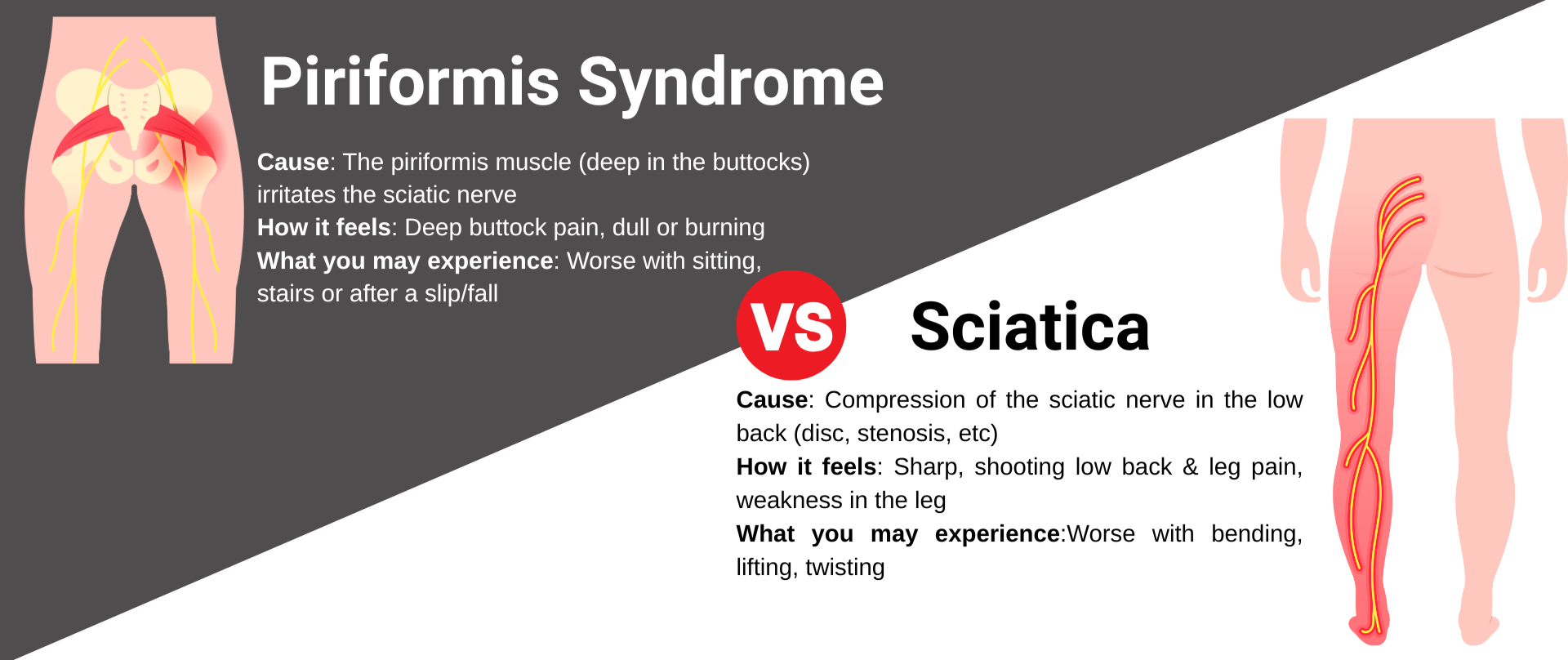 Piriformis Syndrome vs. Sciatica: What’s Causing That Pain in Your Back or Leg?