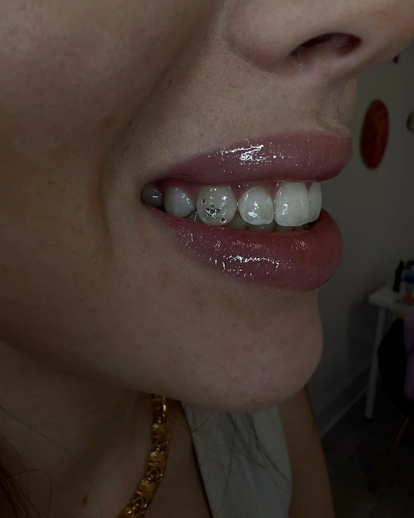 Micro star & 2 small round tooth gems - the cutest little design!! 🫶🏻
📍Glasgow city centre