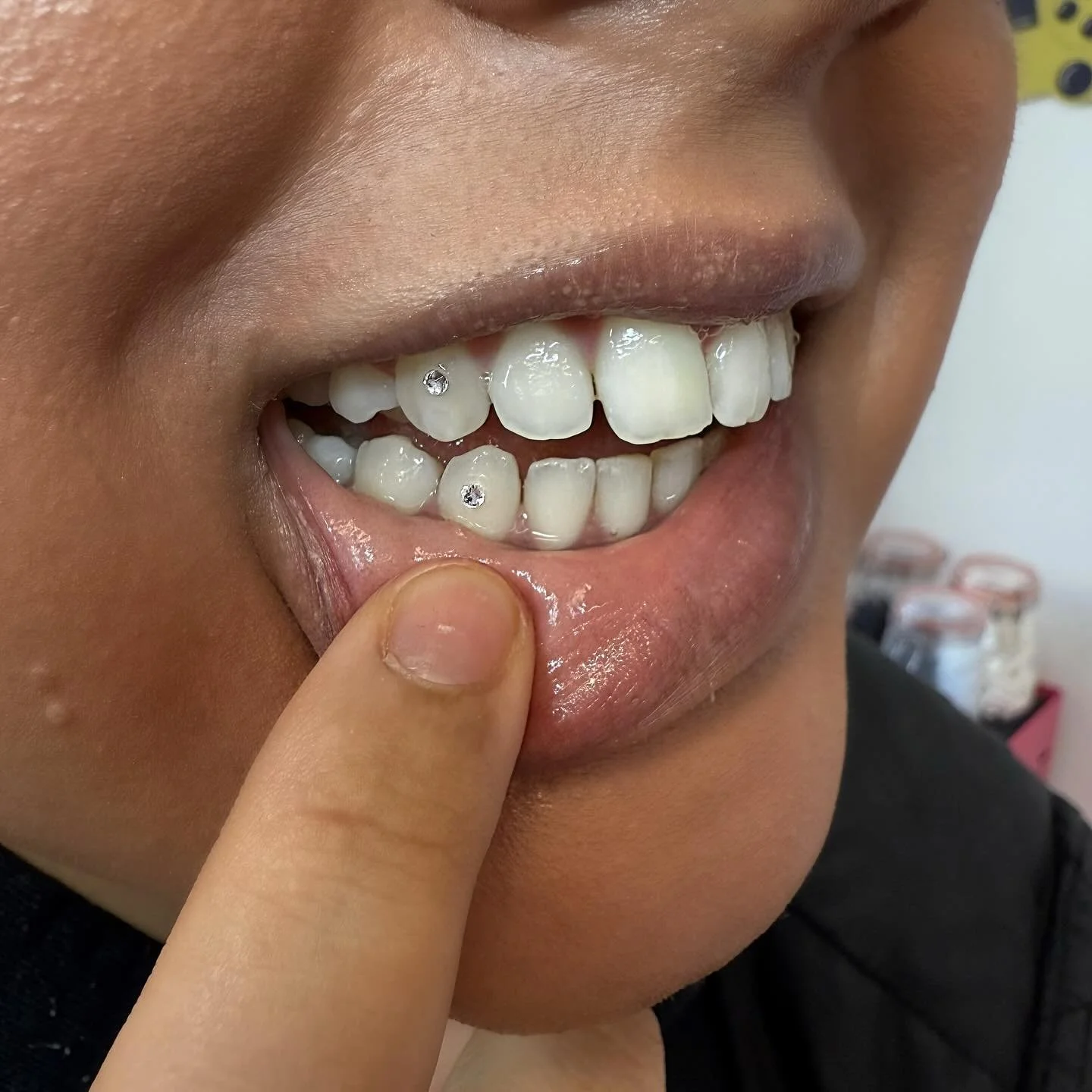 Tooth gems on the lower set of teeth are SO much fun - you guys should go for this option more! Subtle but cuuuute 💕
🗓️ Next availability 16th November 
📍Glasgow city centre