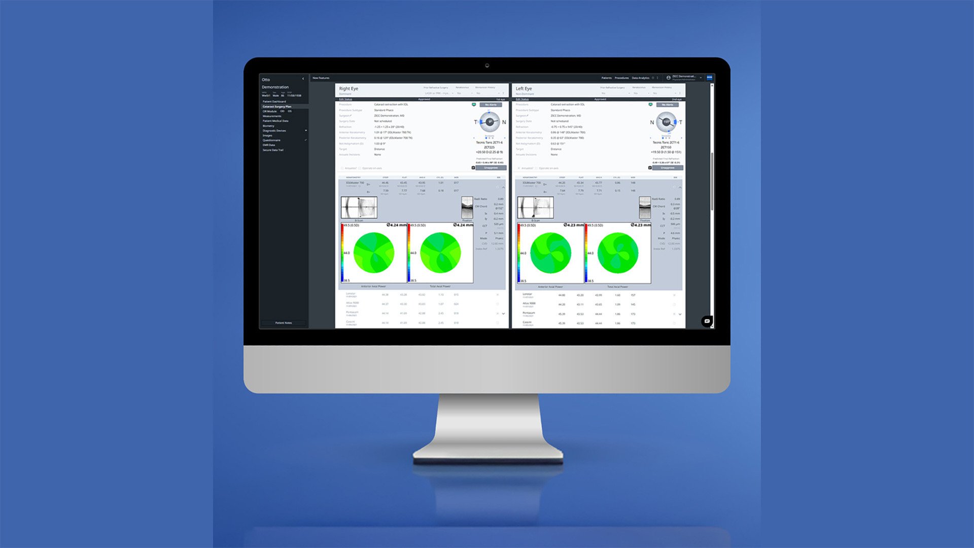 ZEISS continues to drive digital era forward in ophthalmology; celebrates 2 million digitally-planned cataract cases in the U.S. alone