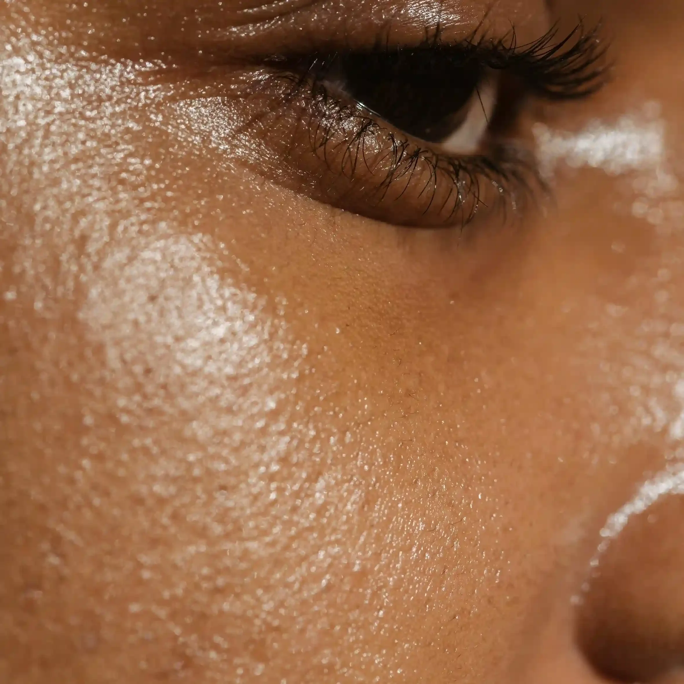 Tratamiento de relleno de pómulos para rejuvenecimiento facial en Badalona Barcelona