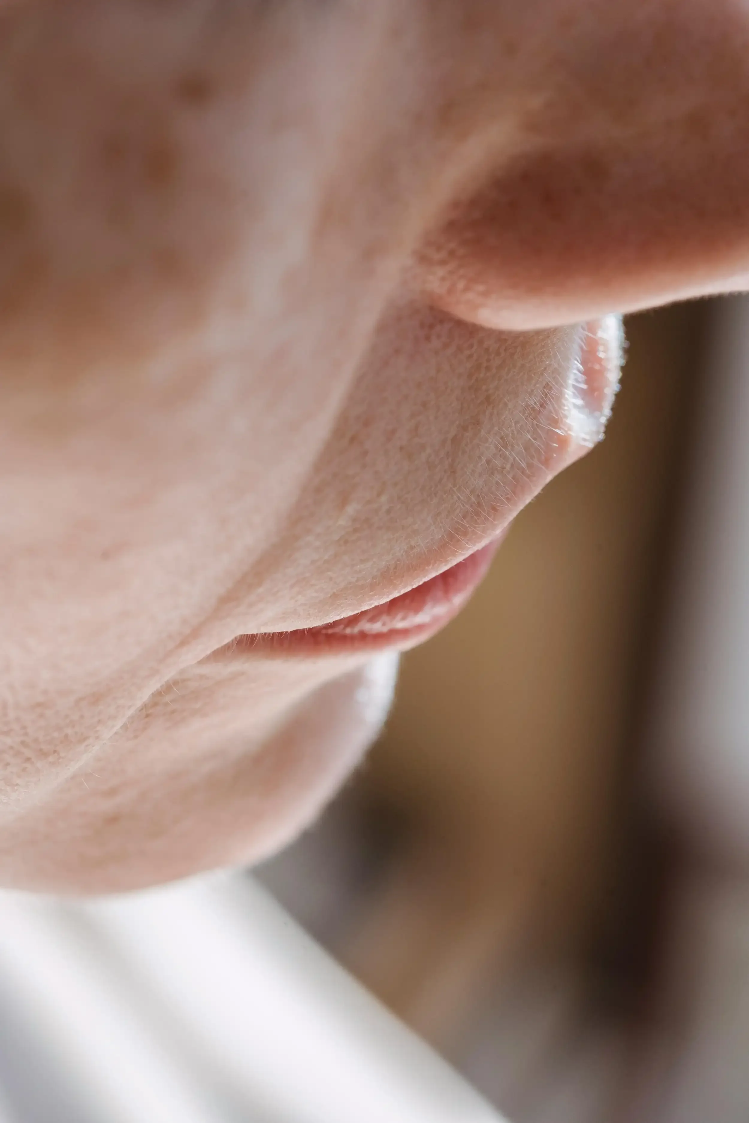 Tratamiento para arrugas del labio superior con medicina estética facial en Badalona