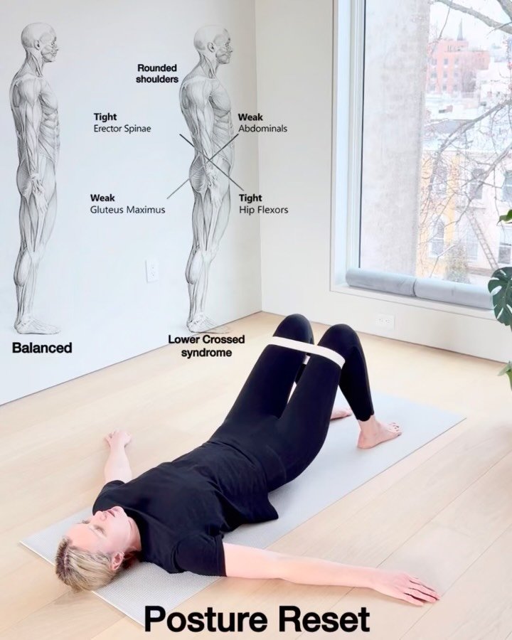 Lower Crossed Syndrome

We sit too much. We move too little. And our bodies are paying the price.
Low back pain, tight hamstrings, knee pain, neck tension, headaches, none of this is random.
Some muscles get too tight, while others &mdash; especially