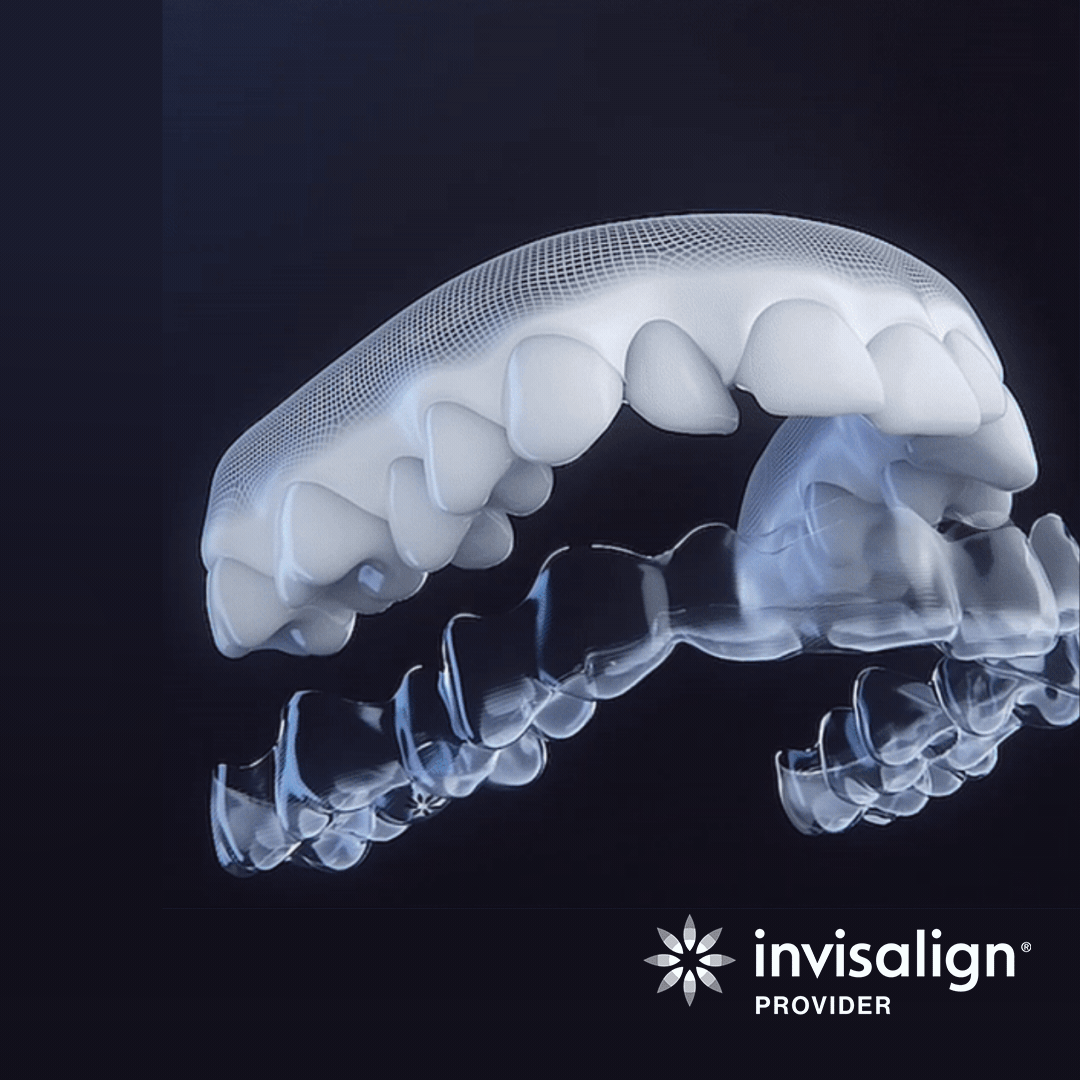 invis-is_Aligner_Social-Post_8_GIF.gif