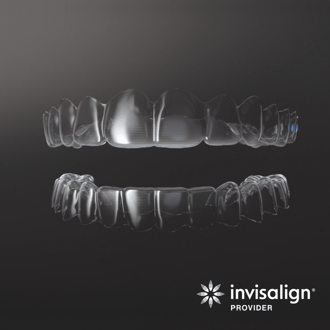 invis-is_Aligner_Social-Post_3_GIF.gif