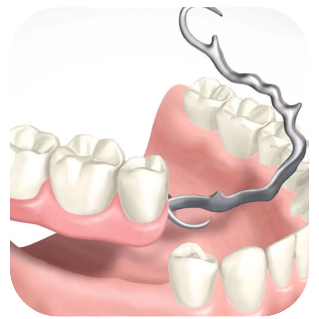 Prótese Dentária