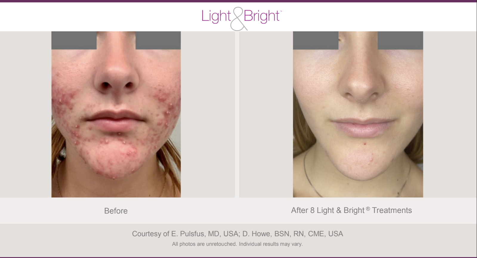 Screenshot 2026-02-04 at 3.24.53 PM.png