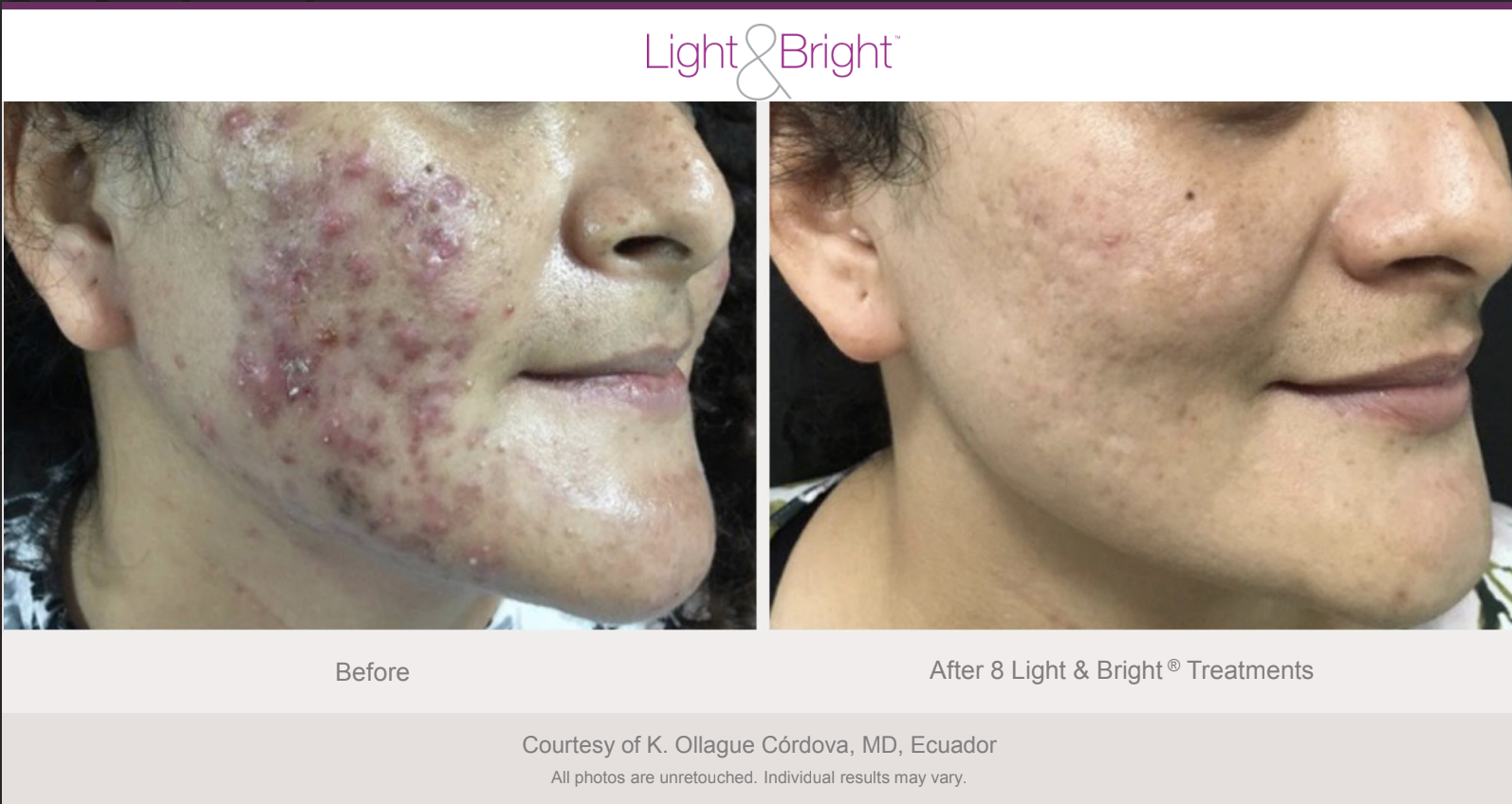 Screenshot 2026-02-04 at 3.24.34 PM.png