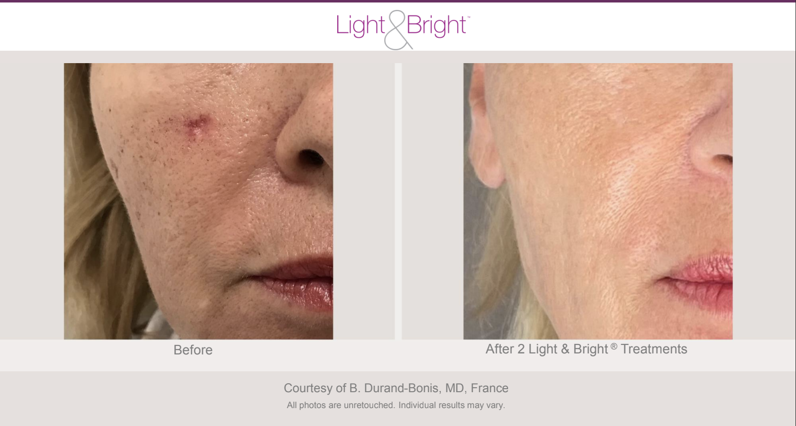 Screenshot 2026-02-04 at 3.22.53 PM.png