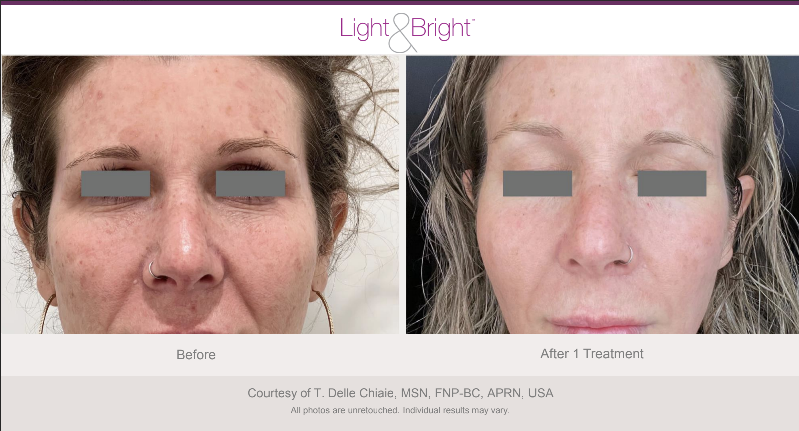 Screenshot 2026-02-04 at 3.21.56 PM.png