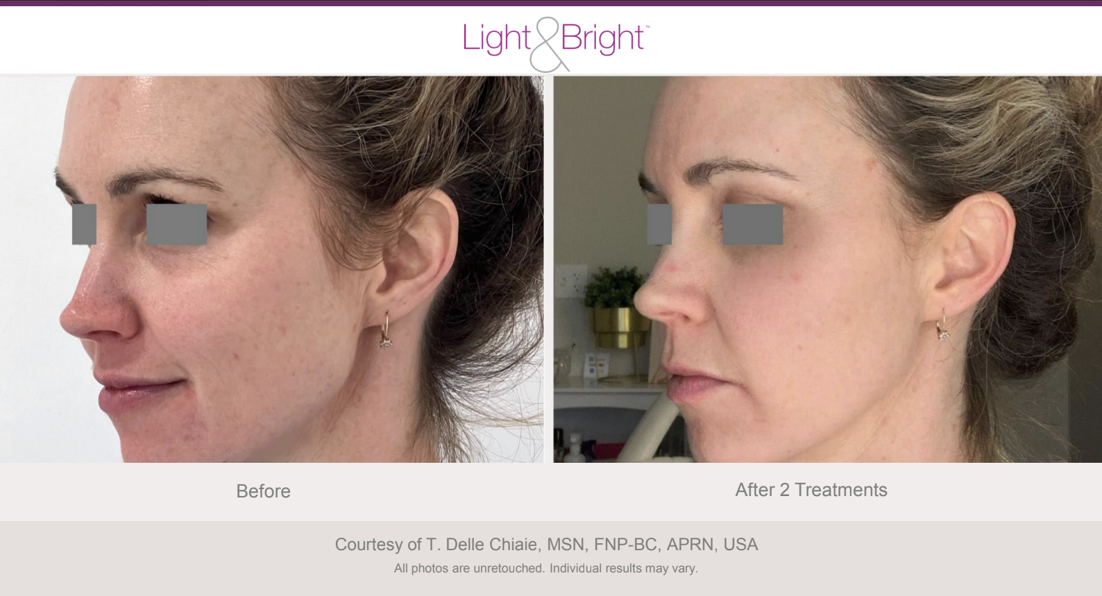 Screenshot 2026-02-04 at 3.21.50 PM.png