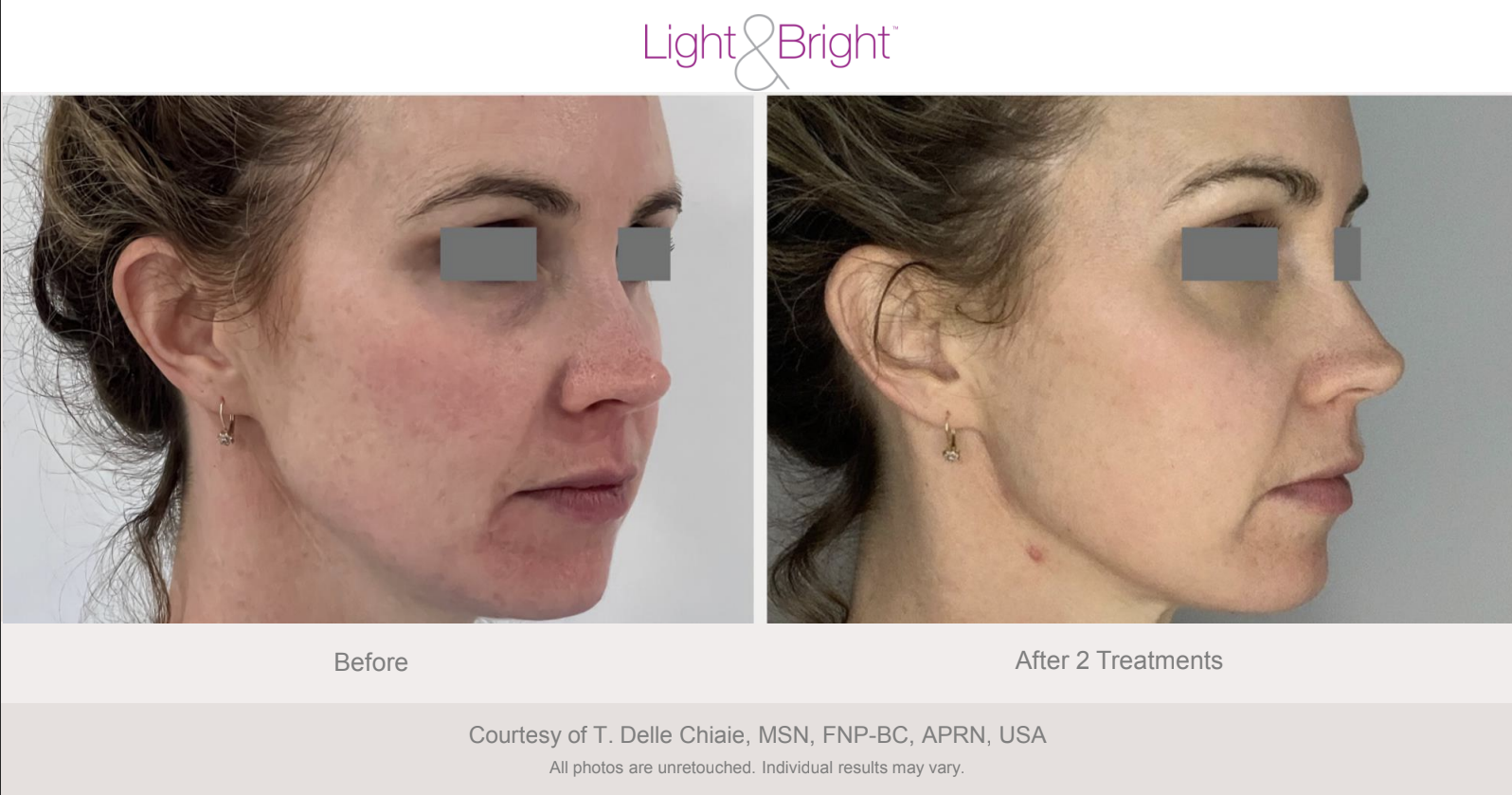 Screenshot 2026-02-04 at 3.21.47 PM.png