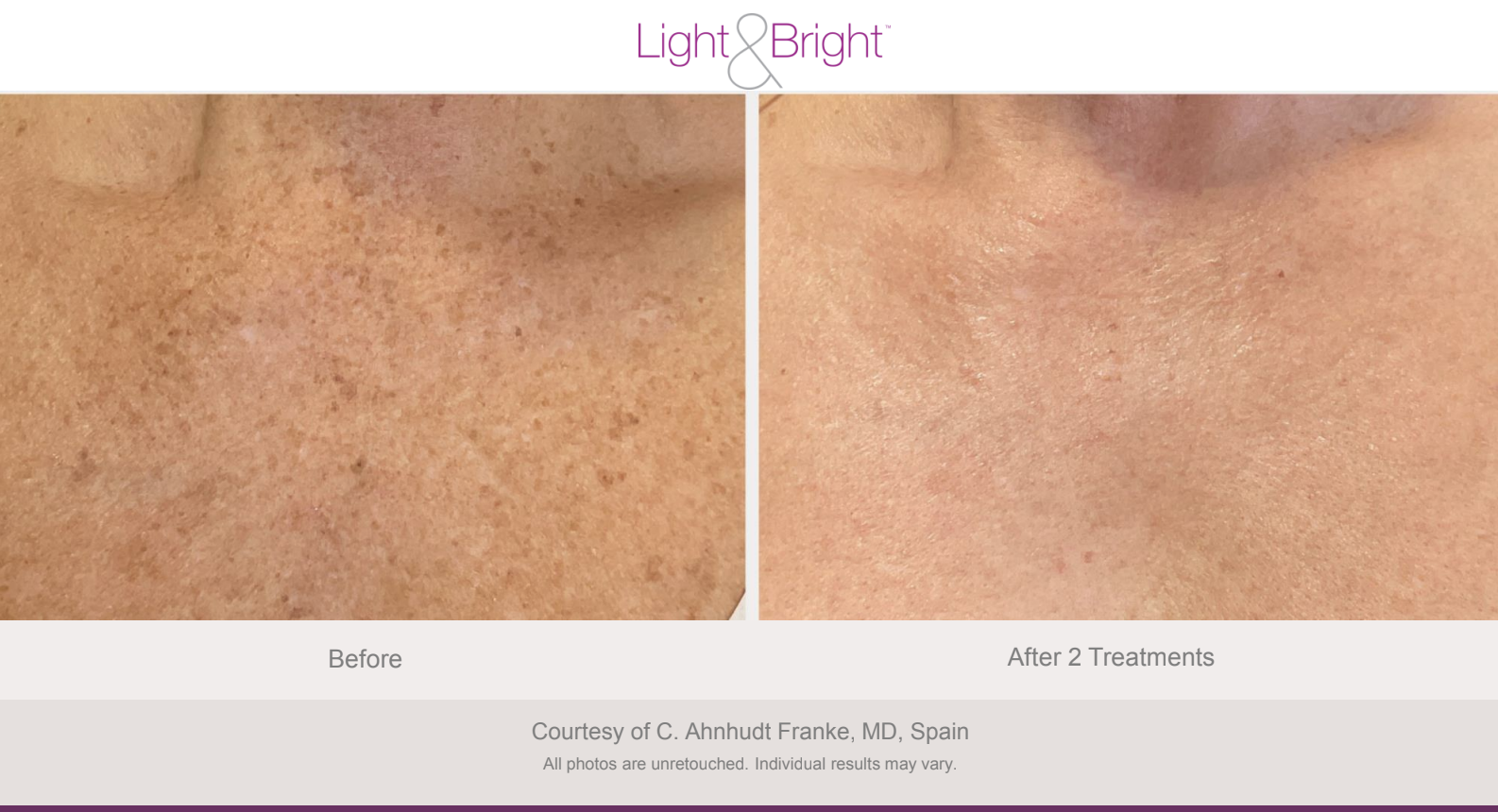 Screenshot 2026-02-04 at 3.21.41 PM.png