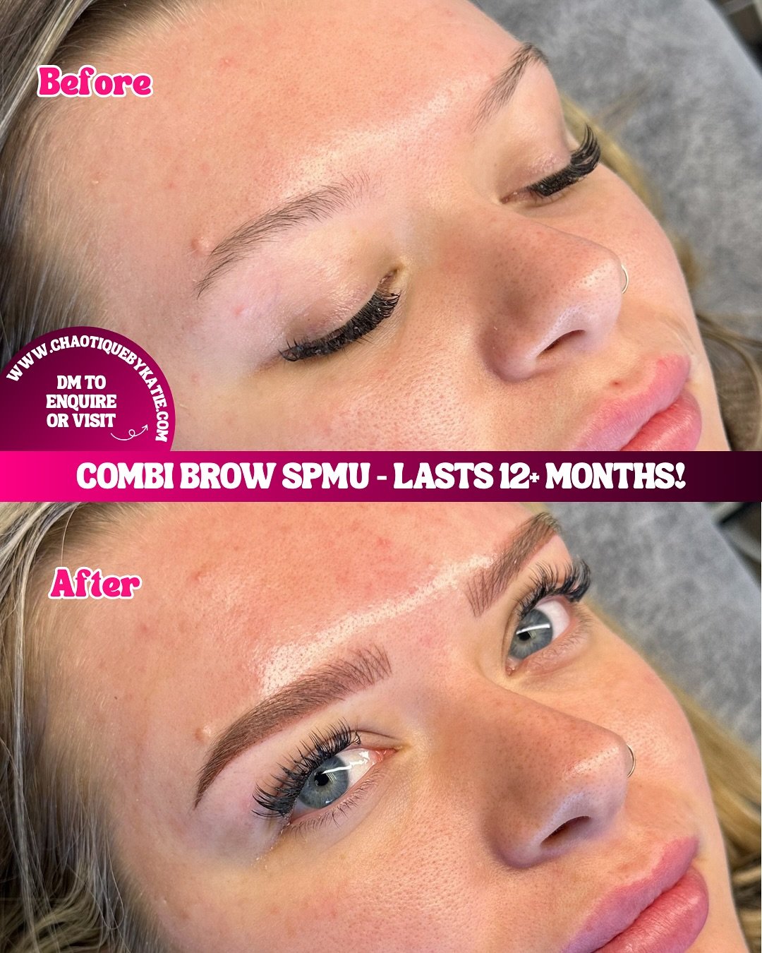 PURRRRRRR&nbsp;😻&nbsp;these combi brows are absolutely giving glow up! My client wanted something similar to how she does her makeup and bbyg, we smashed it ✨&nbsp;

🔥 I currently have an offer of 20% off all SPMU services - just schedule your appo