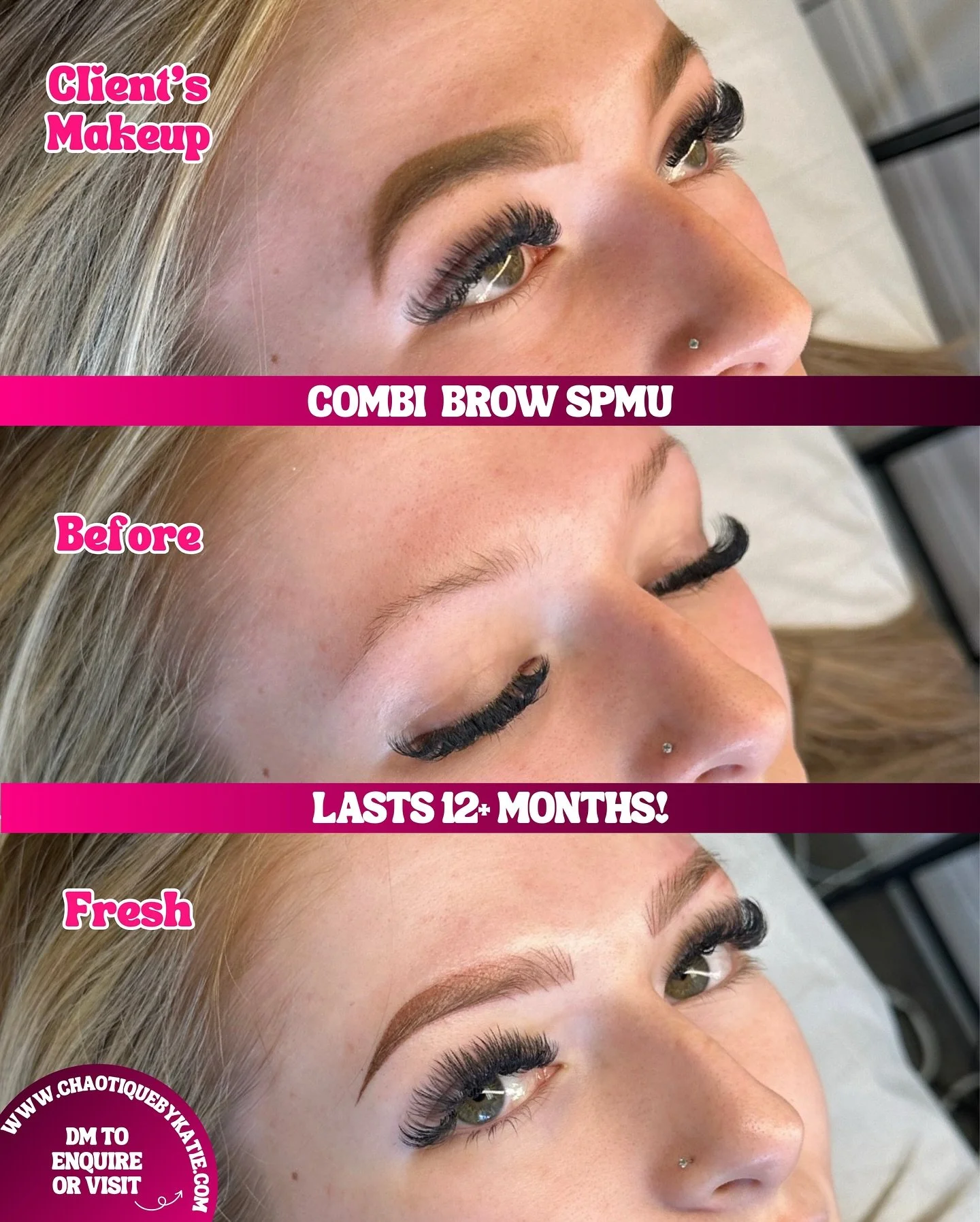 🔥 COMBI BROWS 🔥

Combi is a combination of Ombre and Hairstroke! The front of the brow is enhanced with fine lines which replicate hairs, then the tail of the brow replicates powder, similar to makeup 💕

✨ Loving this look? Get in touch! I&rsquo;v