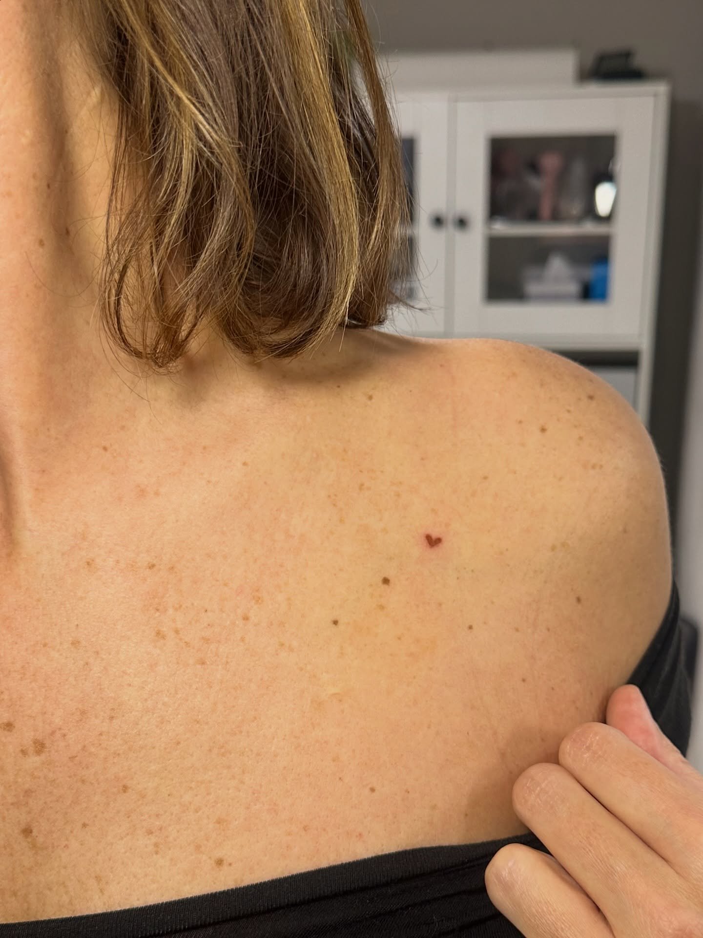 How adorable are these miniature heart freckles 😍 

Taking my client&rsquo;s beautiful existing freckles into consideration, we carefully planned out where would look best (down to the millimetre!) for a subtle little twist 🤎 

Once healed, they&rs