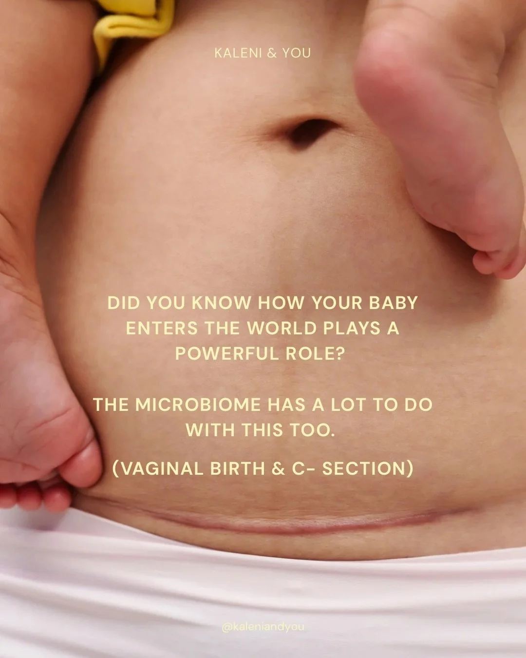 Birth is just the beginning of your baby's gut story.

Swipe to learn what&rsquo;s really happening inside and how to support it 💛

If you want to find out more, you can find our colic guide link on bio ✨📃

#babygut #guthealth #csection #vaginalbir