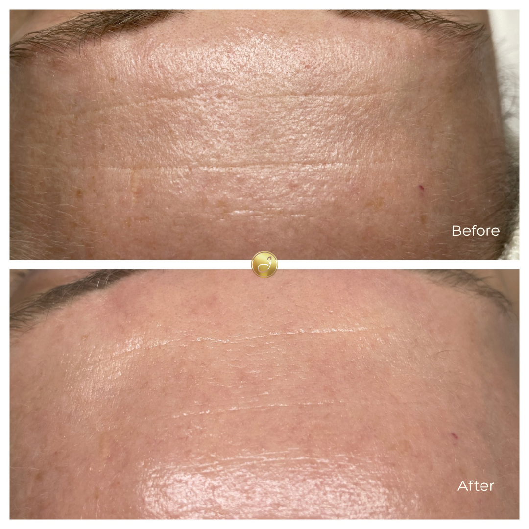 CELLSTORY MARKETING - 11.png