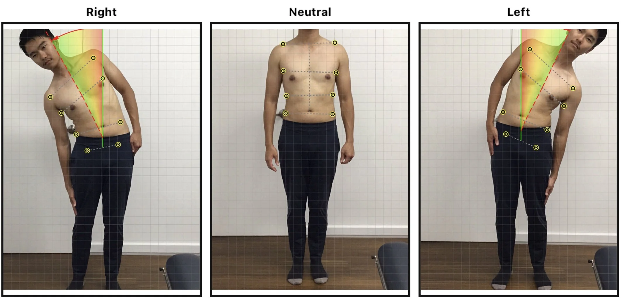 Side and front views of a shirtless man with grid lines and marked points used for posture assessment, showing different body alignment angles from right, neutral, and left perspectives.
