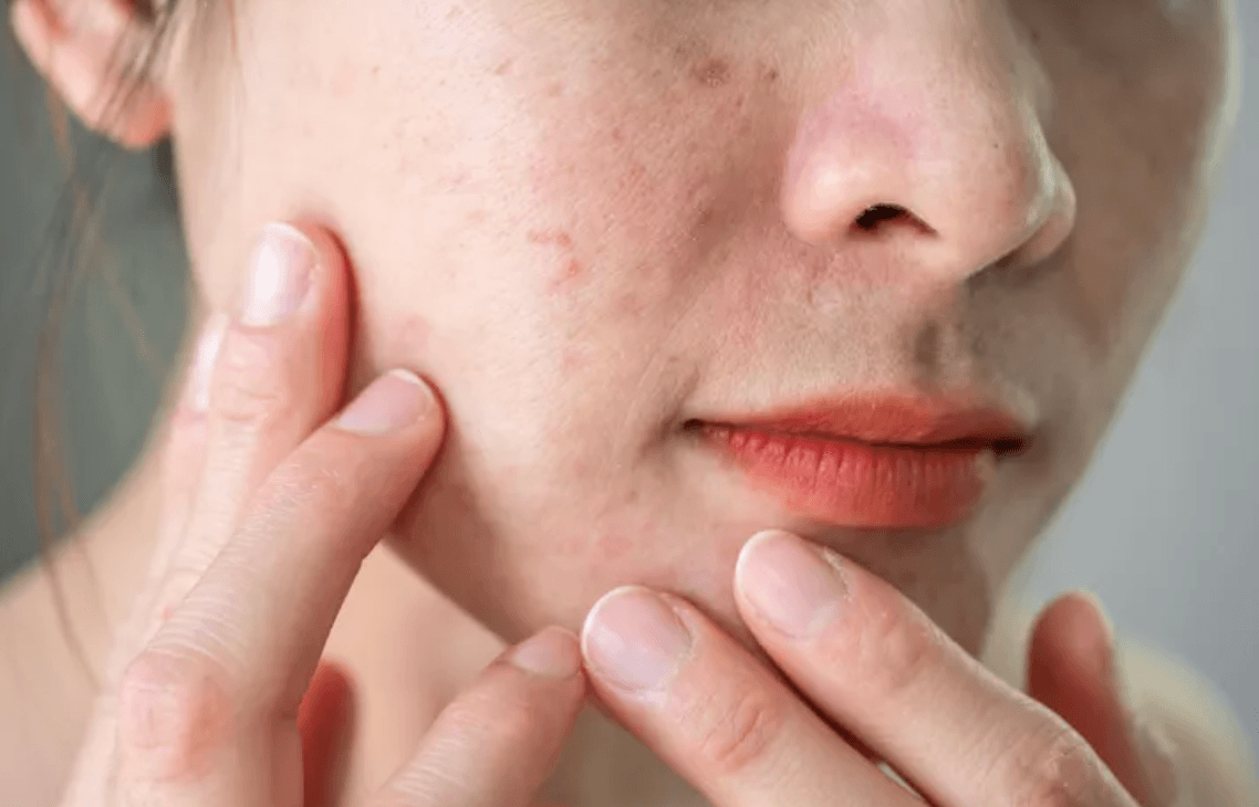 Why Your Skin Feels Rough - and What to  Do About It