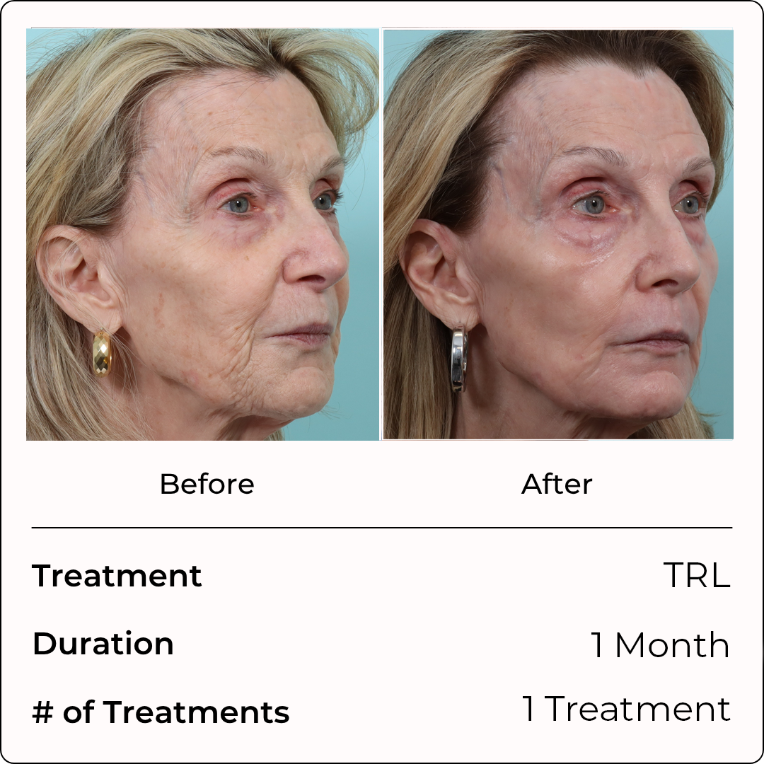 TRL (Copy) (Copy)