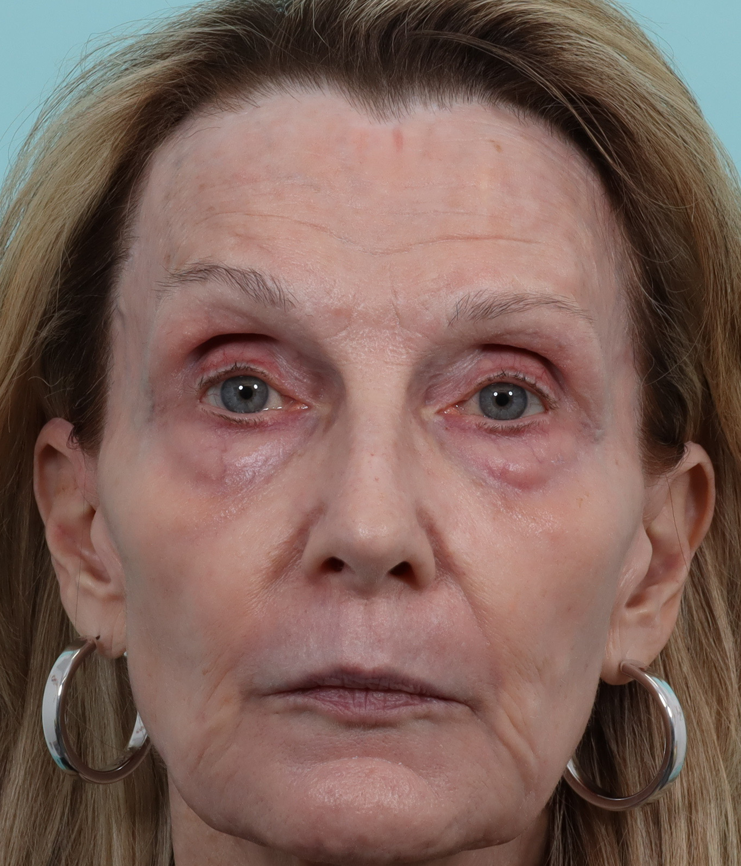 fr contour trl after.png