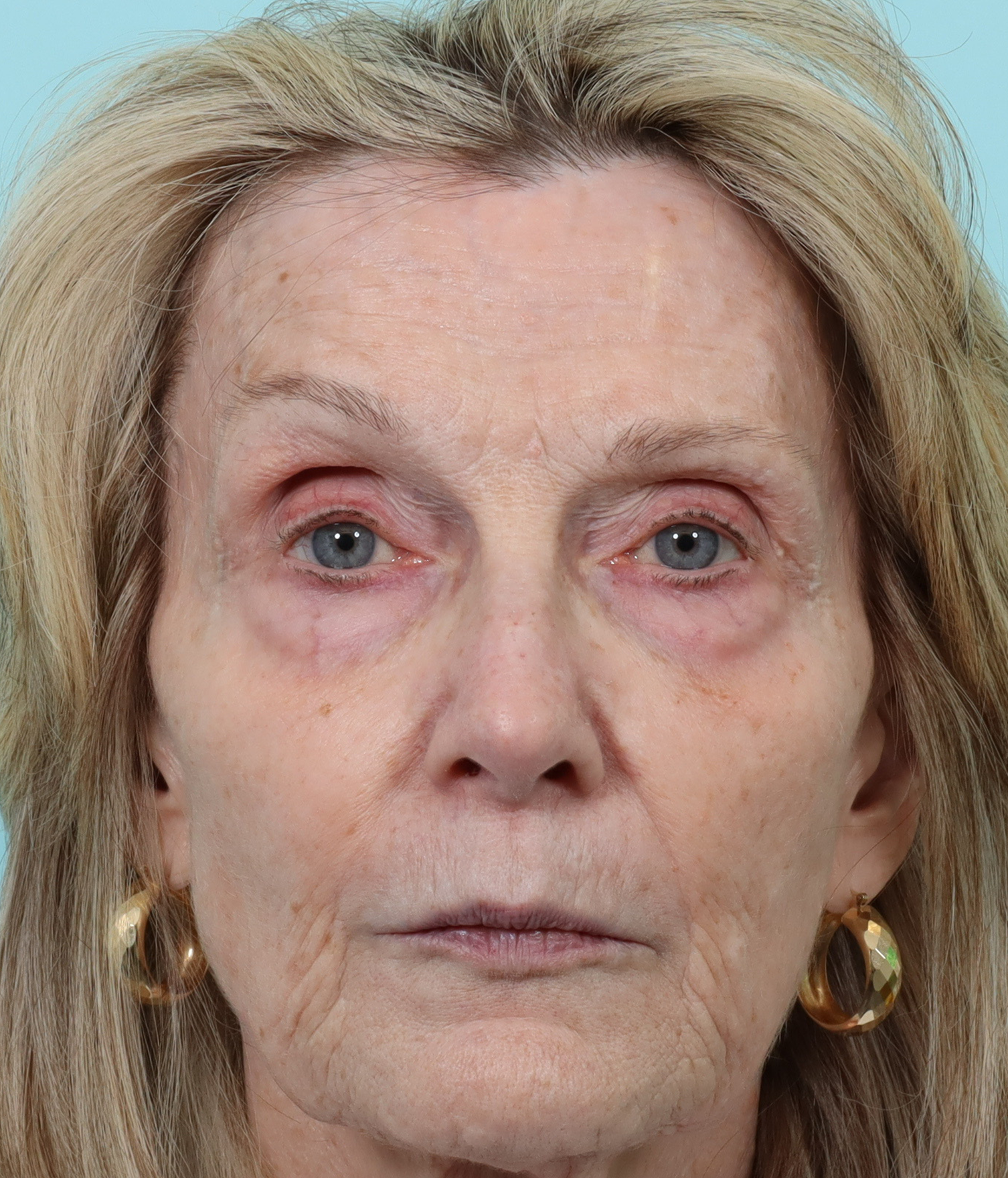 fr contour trl before.png