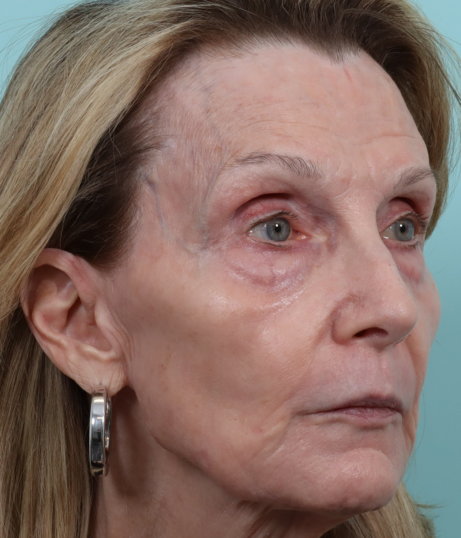 right contour trl aft.png