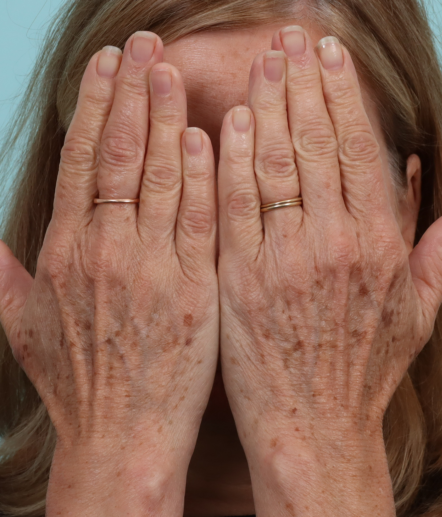 hands before bbl.png