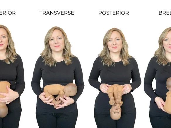 Sunny Side Up Baby: What to Know About the Posterior Position ...