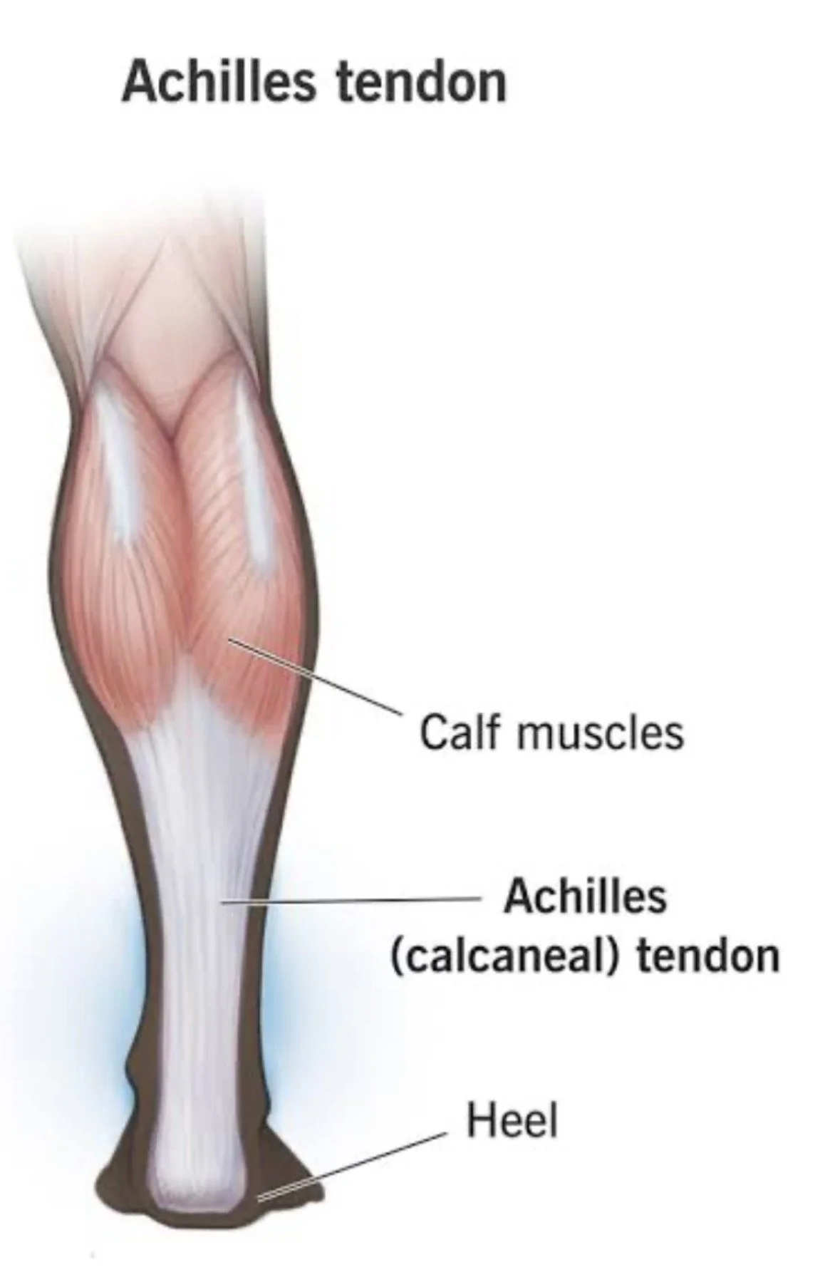Calf &amp; Achilles Tendon Rehab: From Pain Relief to Strength &amp; Plyometrics