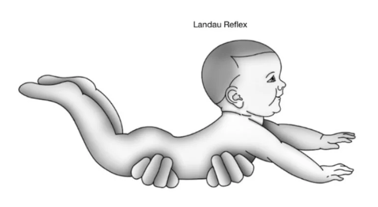 landau reflex