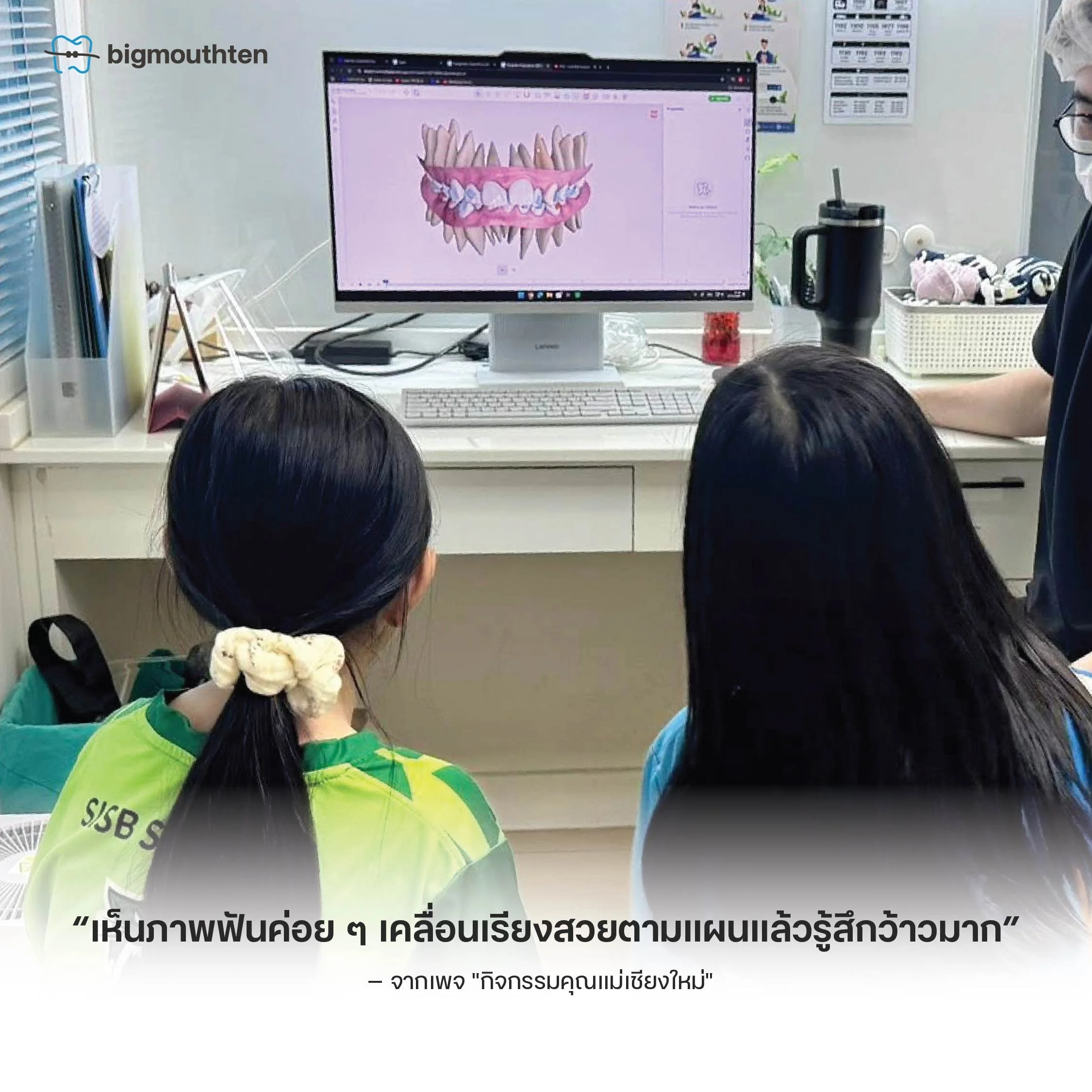 การอธิบายแผนจัดฟันใสแบบดิจิทัลให้ผู้ปกครองและเด็กก่อนเริ่มรักษาที่คลินิกเชียงใหม่