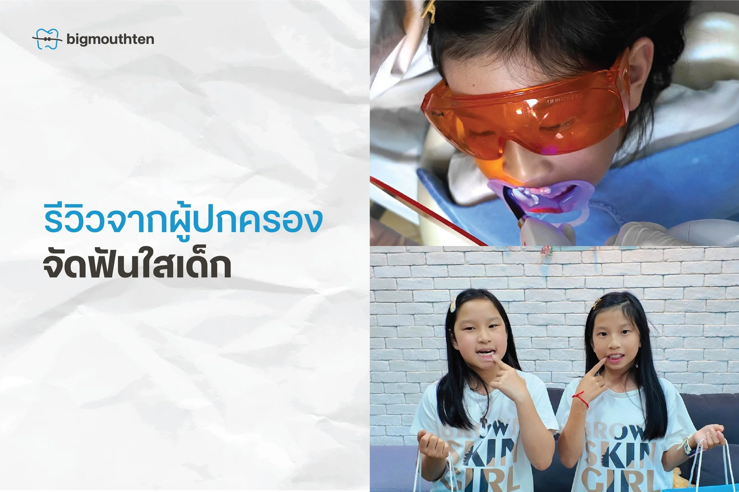 จัดฟันใสให้ลูก: ประสบการณ์วันแรกกับ Spark Aligners