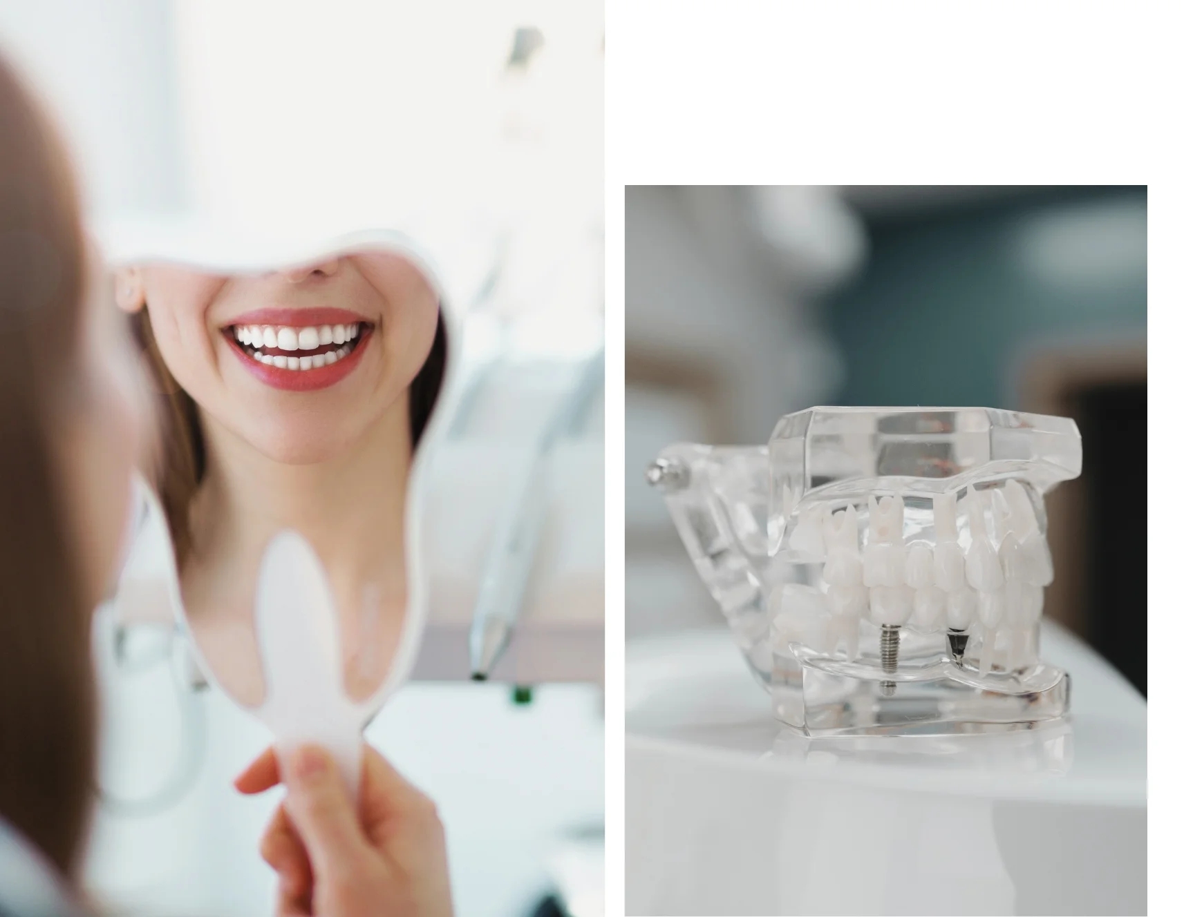 Dental implant aftercare instructions following implant surgery at Bigmouthten Dental Clinic in Chiang Mai