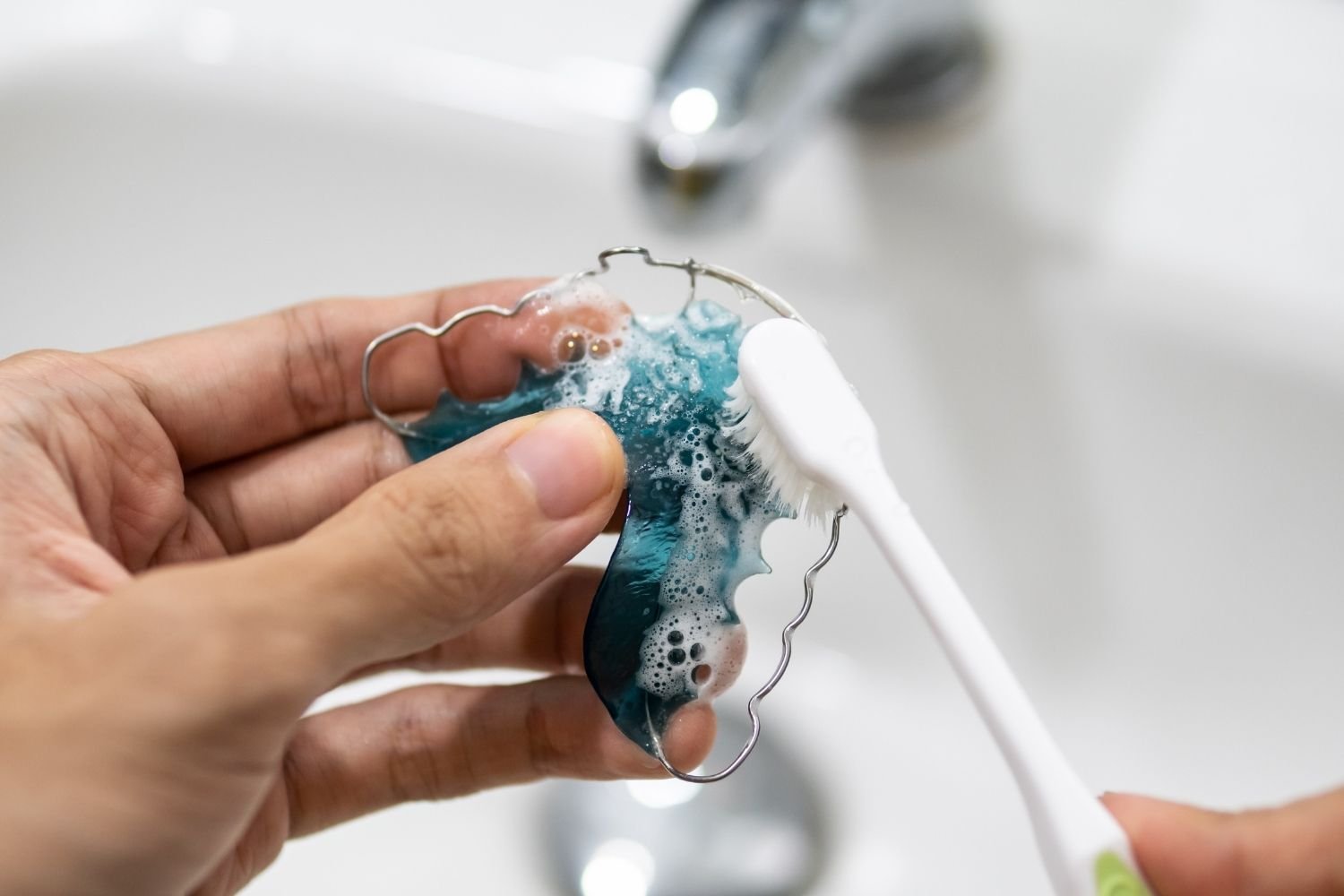 orthodontic braces chiangmai | จัดฟันเชียงใหม่