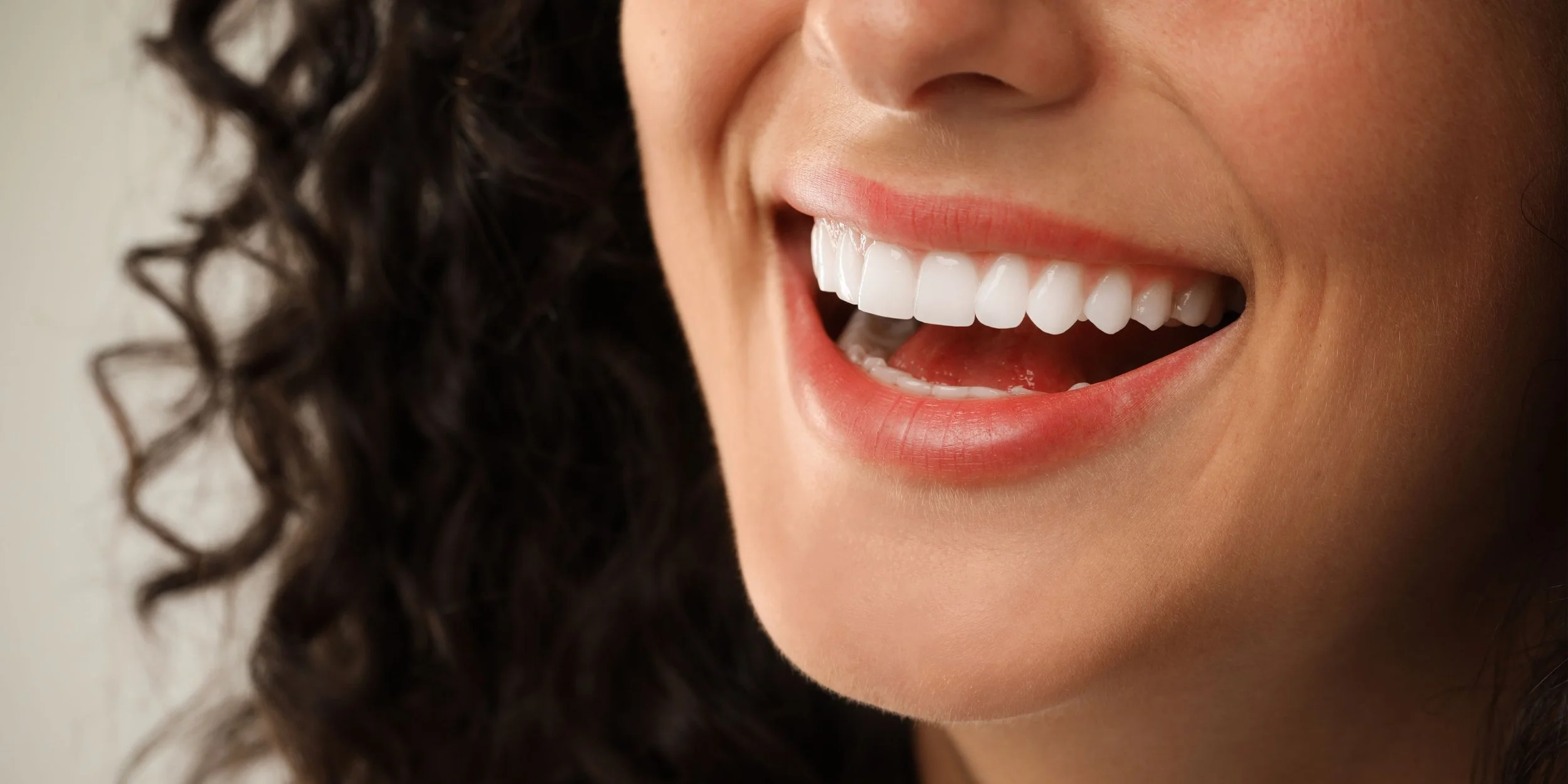 cosmetic-dentistry-veneers-treatment.jpg aesthetic-dental-veneers-smile.jpg
