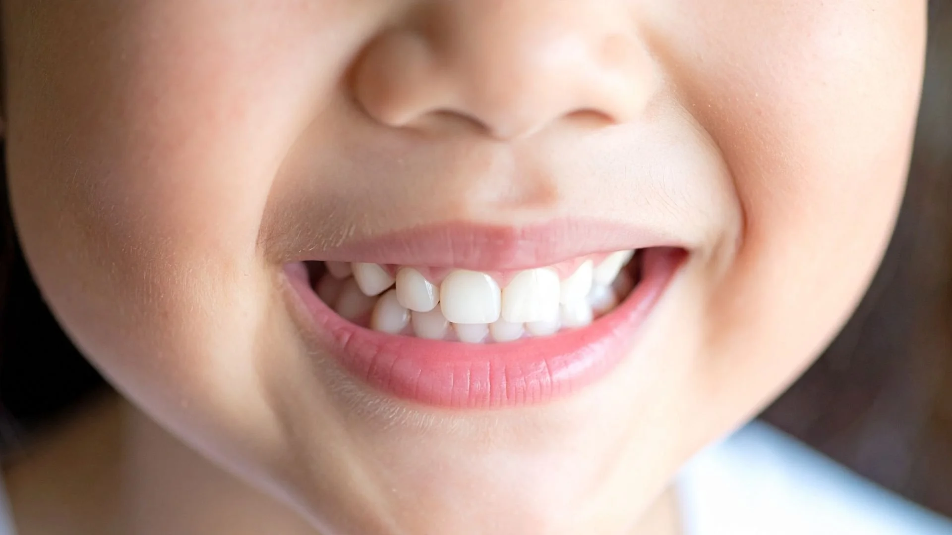 after fluoride treatment care at dental clinic in Chiang Mai