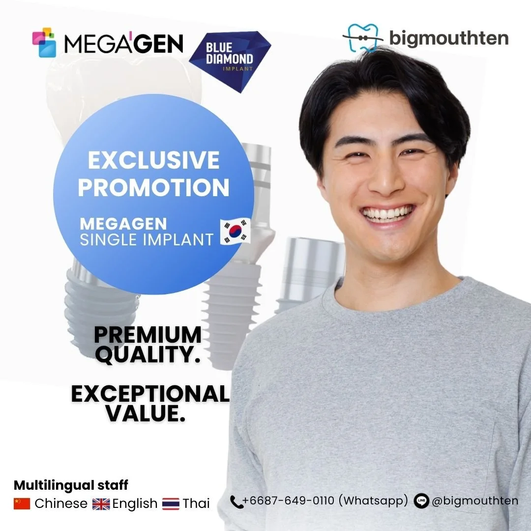 An advertisement for dental implant services featuring a smiling man and logos of MegaGen, Blue Diamond Implant, and BigMouthTen. It highlights a promotion for MegaGen single implants, emphasizing premium quality and exceptional value, with multiling