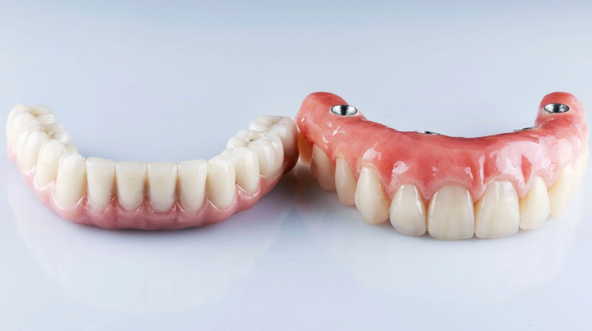 A professional dental clinic setting showing a high-quality dental implant model for All-on-X full mouth restoration.