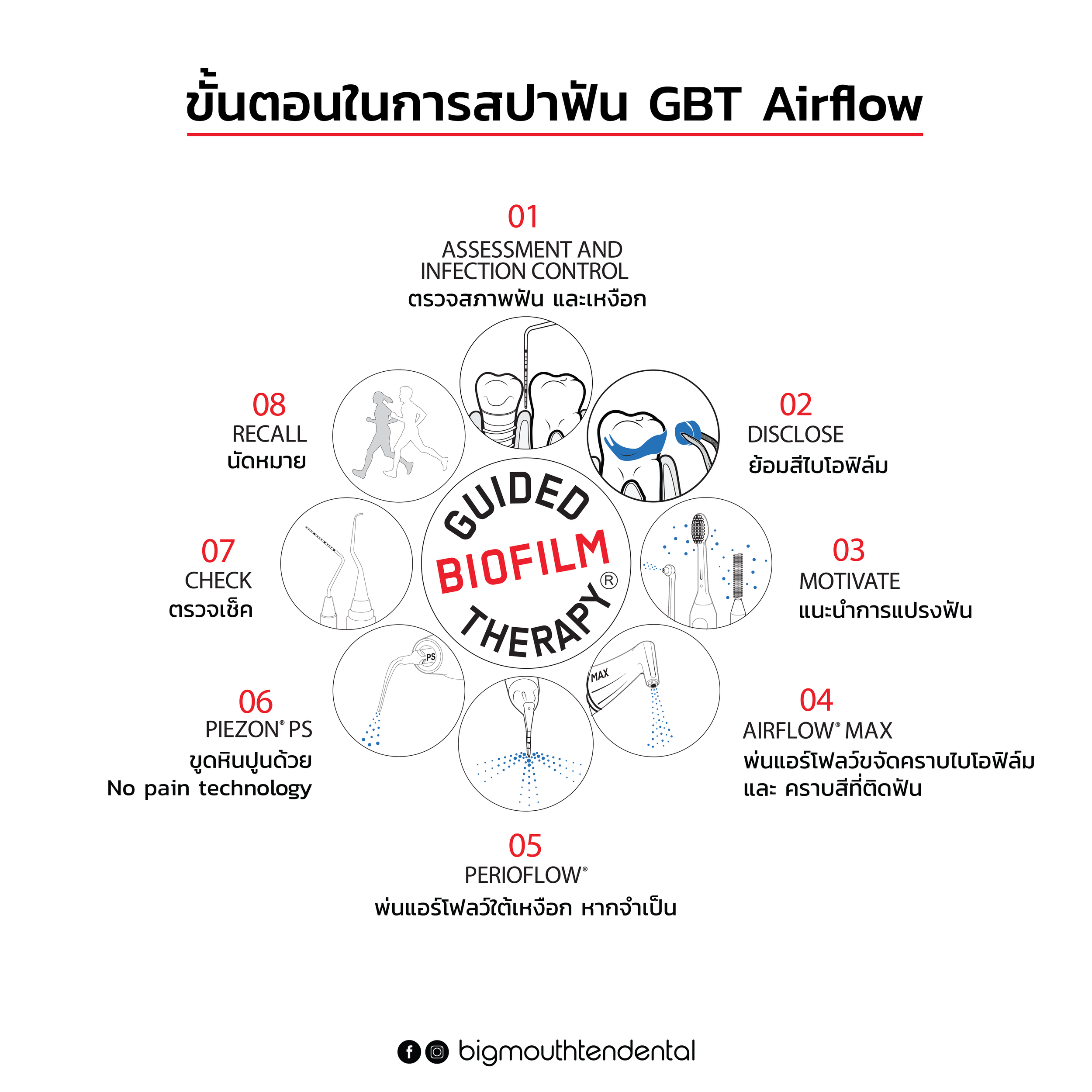 ขั้นตอนการทำ GBT Airflow ที่ Bigmouthten คลินิกเชียงใหม่ ขจัดคราบจุลินทรีย์ คราบชา กาแฟ อย่างอ่อนโยน